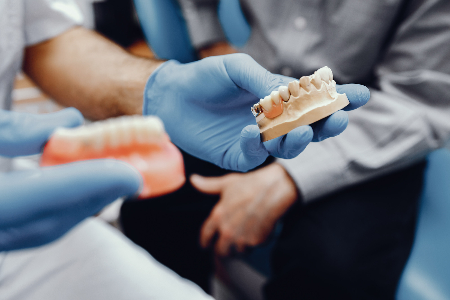 All-on-4 implant problem